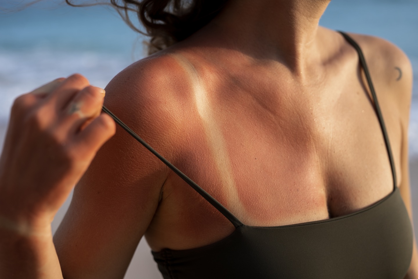 Be SunSmart and Stay Ahead of Skin Cancer Image