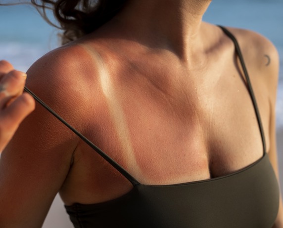Be SunSmart and Stay Ahead of Skin Cancer Be SunSmart and Stay Ahead of Skin Cancer